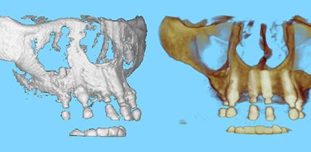 Sistema Digital Imágenes DOLPHIN